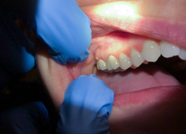Best Emergency Pediatric Dentist  in Chevy Chase, MD